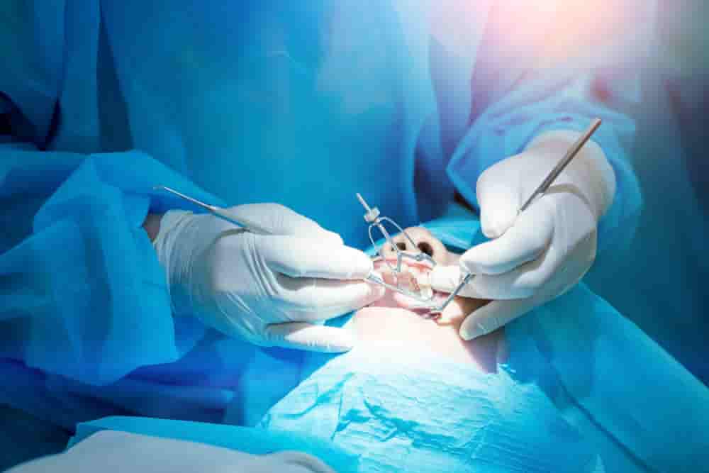 Cost of Periodontal Surgery