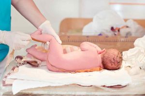 Failure to Thrive government assistance for premature babies